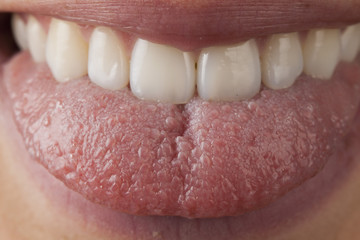 Obraz premium Lengua y dientes