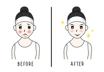 vector woman face. acne before and after. skin care illustration.