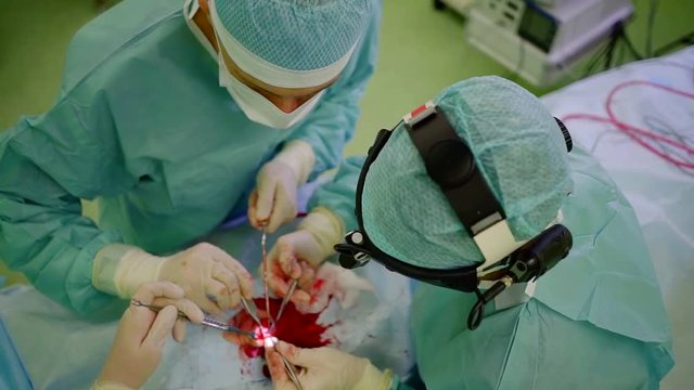 top view of working surgeons and patient lying on table, during rhinoplasty operation