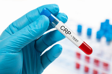 Blood sample for CRP test