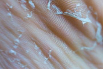 background, old dry skin on the foot