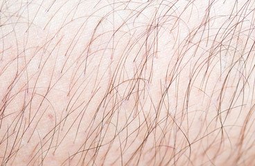Hair on the body of the macro