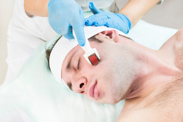 The man undergoes the procedure of medical micro needle therapy with a modern medical instrument derma roller. 