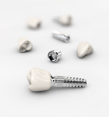Dental implant on the white background, 3d illustration