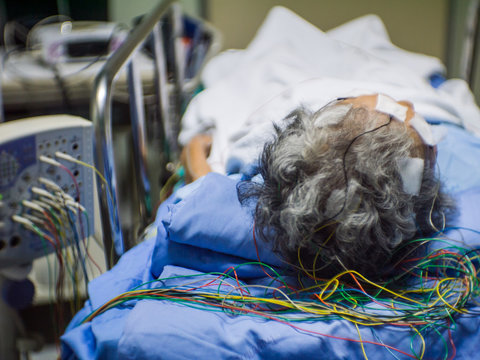 Blurred of elderly patient with encephalography electrode. Electroencephalogram,EEG record in clinic.