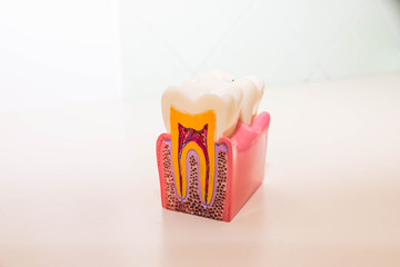 tooth model without caries, tooth decay in dentist's office. Healthy teeth concept . children's...