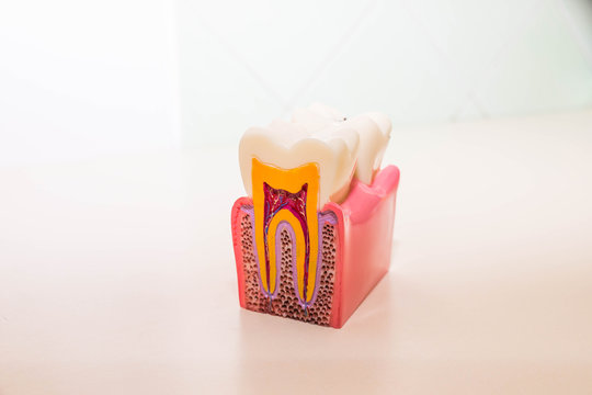tooth model without caries, tooth decay in dentist's office. Healthy teeth concept . children's dentist. Copy space