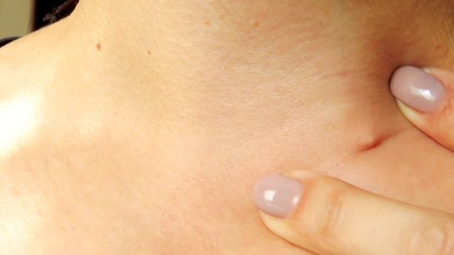 Defect on the skin, pinch.