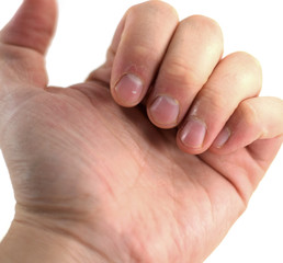 Macro closeup of fingers and dry cuticles of a young man in his 20s (isolated)