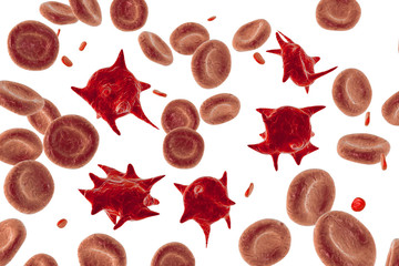 Acanthocytes, abnormal red blood cells with thorn-like projections, 3D illustration. They appear in severe liver disease, vitamin E defficiency, splenectomy, malabsorption, hypothyroidism