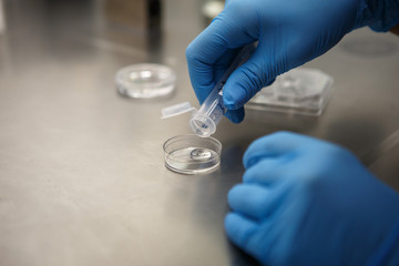 The process of artificial insemination in IVF clinic. Hands doctor in blue rubber gloves produce chemical manipulation in the laboratory with a microscope, tubes, nitrogen