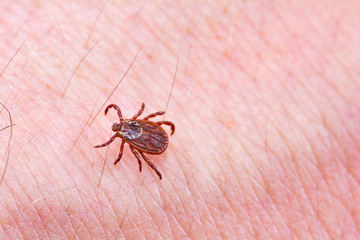 Mite on the skin. Danger of tick bite.
