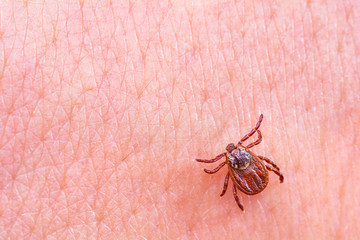 Mite on the skin. Danger of tick bite.