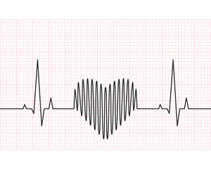 Heart rate line with grid in the background. Heartbeat, pulse and rythm, electrocardiogram and ECG concept. Vector illustration.