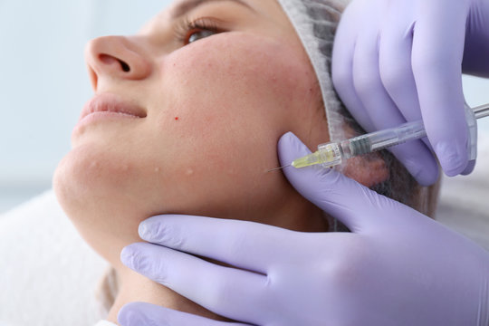 Woman undergoing face biorevitalization procedure in salon, closeup. Cosmetic treatment