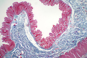 Human large intestine tissue under microscope view.