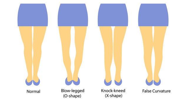 Vector illustration with different shapes of women legs