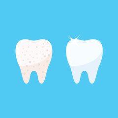 Clean and dirty tooth. Teeth whitening. Dental clinic services. Vector illustration in flat style