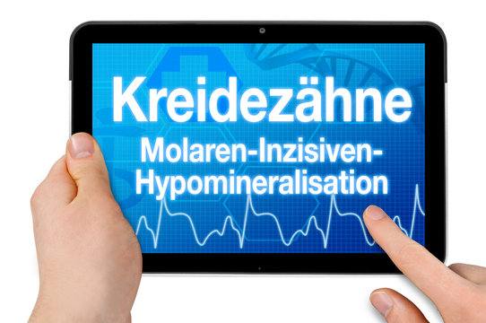 Kreidez&auml;hne Kreidezahn Molaren-Inzisiven-Hypomineralisation Volkskrankheit