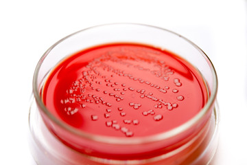 Growth of infectious microbes on Agar