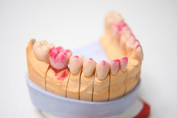 The image of a denture