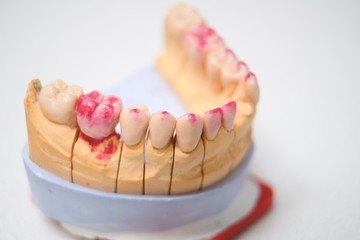 set of the false teeth