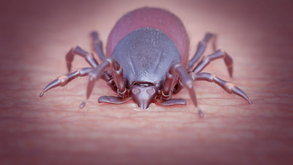 3d rendered illustration of a tick biting a human