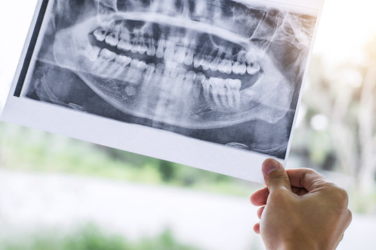 Image of male doctor or dentist holding and looking at dental x-ray