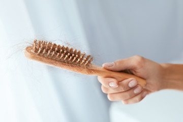 Hair Loss. Hairbrush With Lost Hair In Hand Closeup