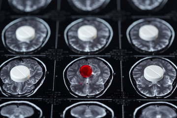 pills and magnetic resonance imaging and X-ray film research results