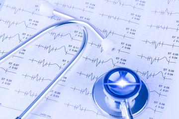 EKG beim Hausarzt mit Lichtreflex