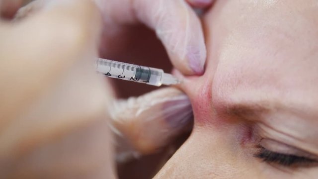 Woman in a cosmetology clinic. Specialist sticks in a needle in clients brow
