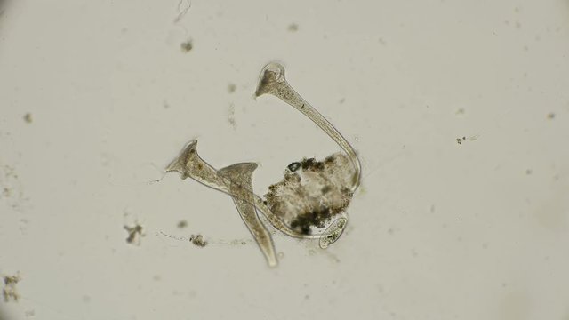 several of the Ciliate Stentor microorganisms stretch out and work with cilia to catch food, under a microscope