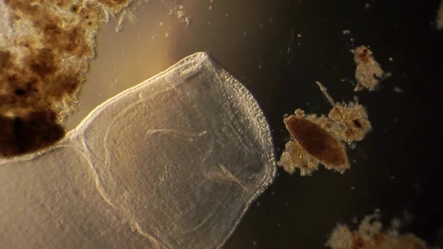 Microscopic arthropod moves slowly, then flinches as it reacts to its environment.