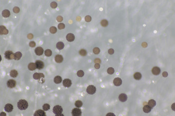 Backgrounds of Colony Characteristics of Fungus (Rhizopus) in petri dish for education.