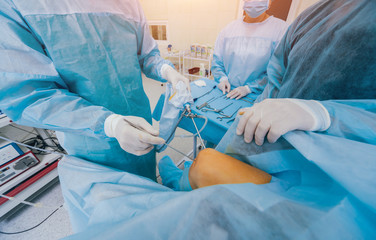 Arthroscope surgery. Orthopedic surgeons in teamwork in the operating room with modern arthroscopic tools. Knee surgery.