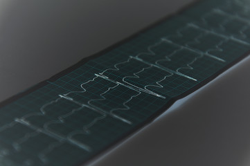 Сlinical diagnosis. Electrocardiography. Normal electrocardiogram with mild arrhythmia. Gray background.