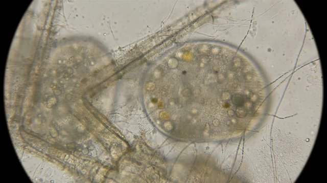 two ciliates Tetrachimena feeding on the remnants of organic flesh, under a microscope