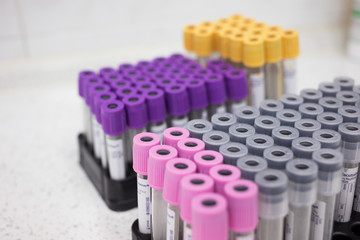 Obraz premium Fryazino, Russia - 06 11 2018: multi-colored tubes for blood, medical items, biomaterial collection, doctor's office concept