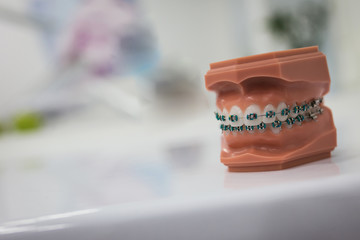 Man's jaw model with braces on white table close up