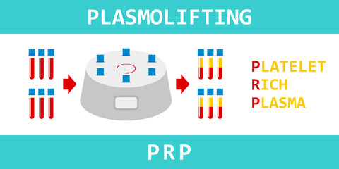 Plasmolifting. Platelet rich plasma. PRP method. Vector.