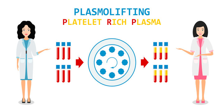 Platelet rich plasma. PRP method. Vector.