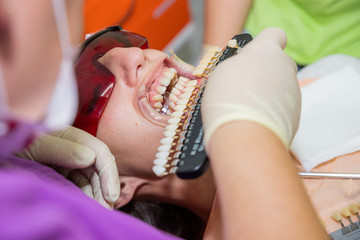 Woman in a Dentist office choosing color of her veneers.dentistry and healthcare concept.dentist with tooth color samples choosing shade for patient teeth at dental clinic.teeth whitening concept