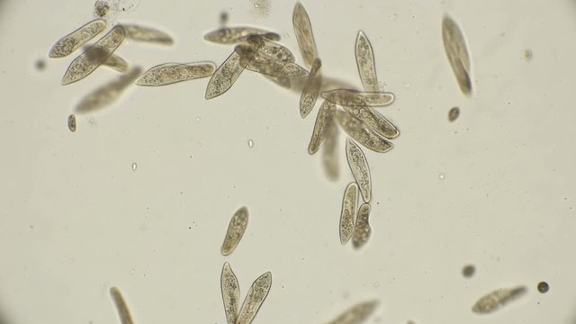 colony Infusorium Param&eacute;cium caud&aacute;tum in motion, under a microscope