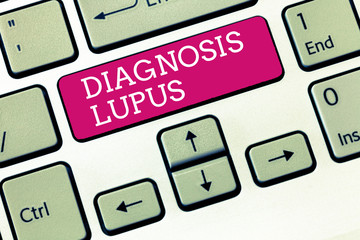 Handwriting text Diagnosis Lupus. Concept meaning Urine examination show an increase of protein...