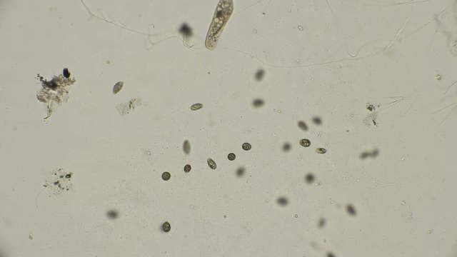 colony of ciliates Coleps, prey on bacteria, which are very much in dirty water, under a microscope