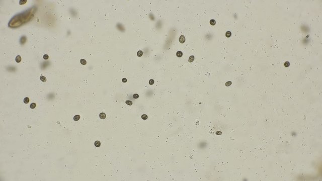 colony of ciliates Coleps, prey on bacteria, which are very much in dirty water, under a microscope