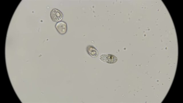 two ciliates Coleps at the stage of division, under the microscope
