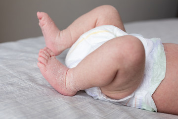 the legs of the newborn baby. the legs of the newborn flaky skin. peel off the skin. peeling skin newborn. newborn child. feet