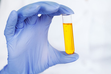 Medicine. Lab Technician Doing Chemistry Experiment. Close Up Of Scientist Checking Test Tube In...